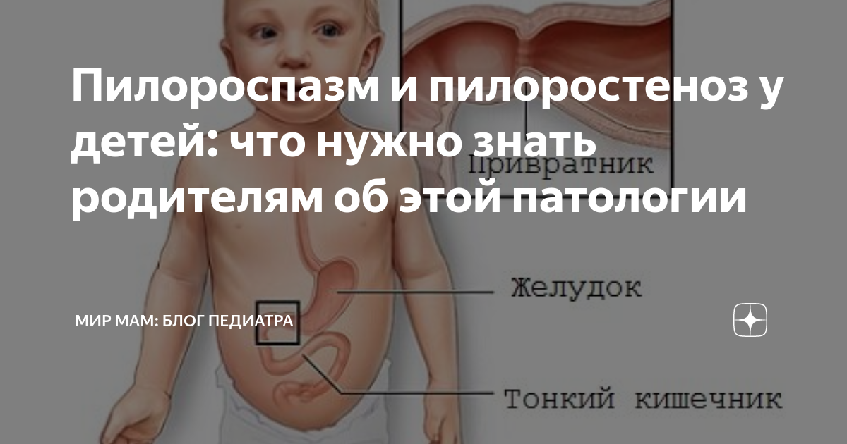 Пилороспазм у детей презентация