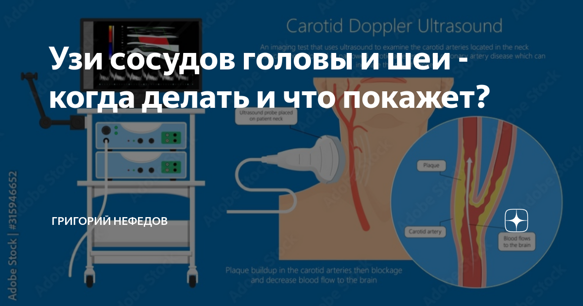 Узи сосудов орск. ИВЛ Drager PULMOVISTA 500. Лекарства от биопсии.