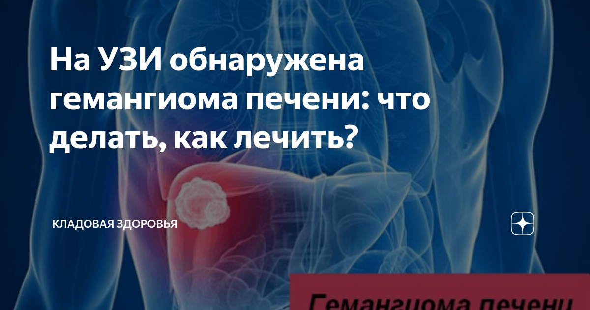 Гемангиома печени: кавернозная, атипичная – диагностика на УЗИ, МРТ, лечение и удаление в Москве