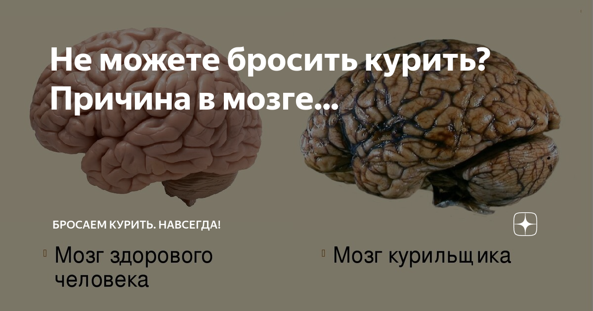 Мозги нормальные. Мозг курящего человека. Рисунок мозг и сигареты.