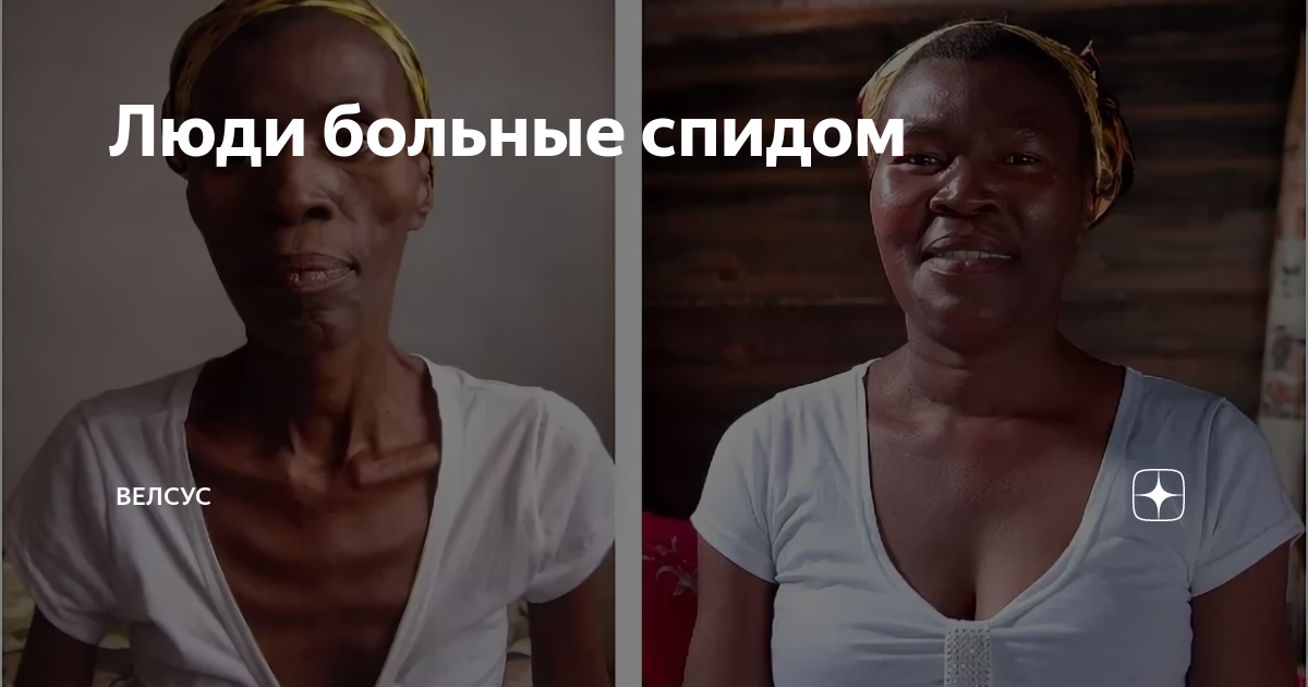 Лечим сами и помогаем лечить другим! - СПИД центр