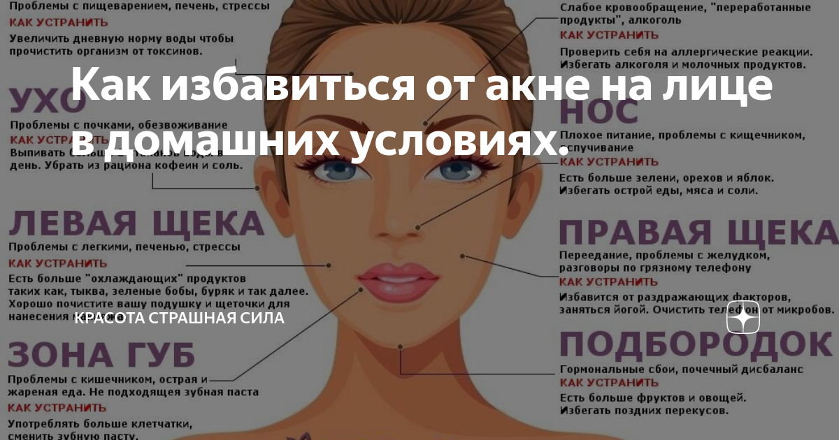 Что такое гнойные прыщи и как от них избавиться?