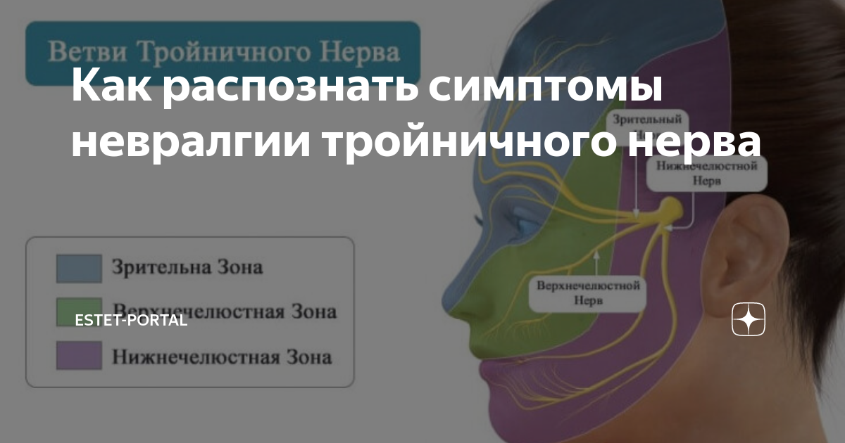 Боль тройничного нерва. Невралгия тройничного нерва симптомы. Воспаление тройничного нерва на лице симптомы. Тройничный нерв симптомы. Симптомы невралгии тройничного нерва лица.