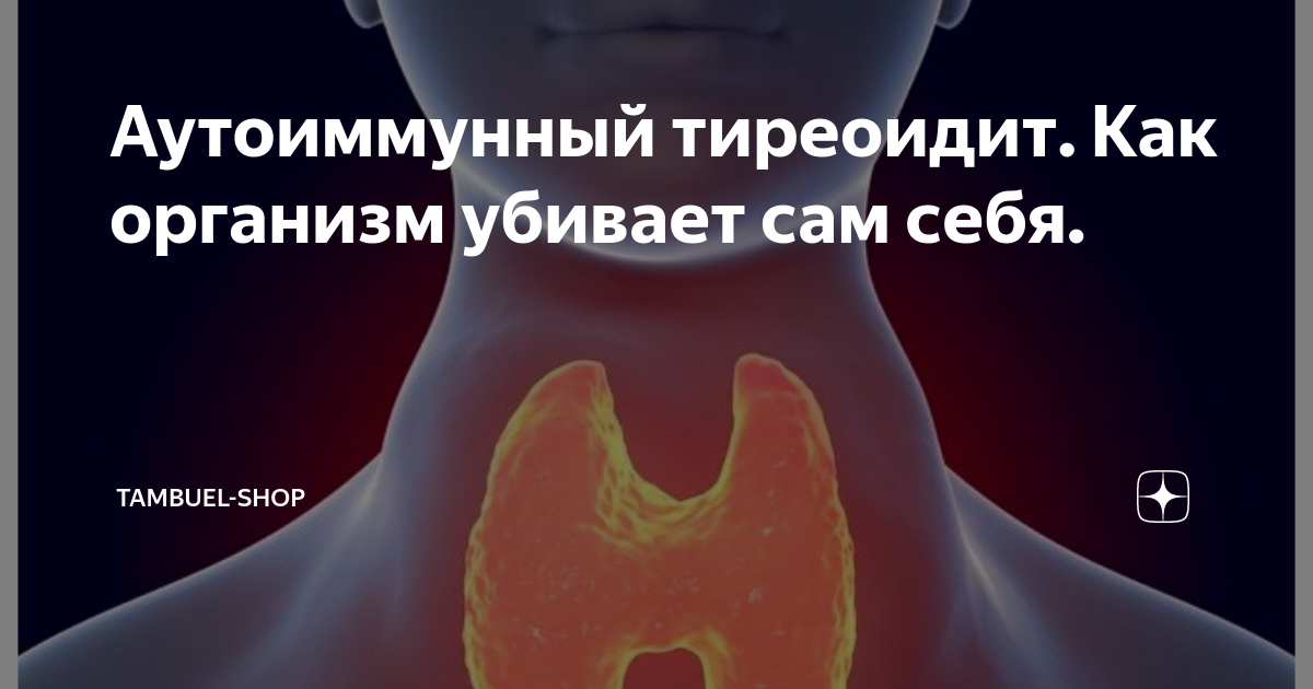 Аутоиммунный тиреоидит - лечение народными средствами: рецепты