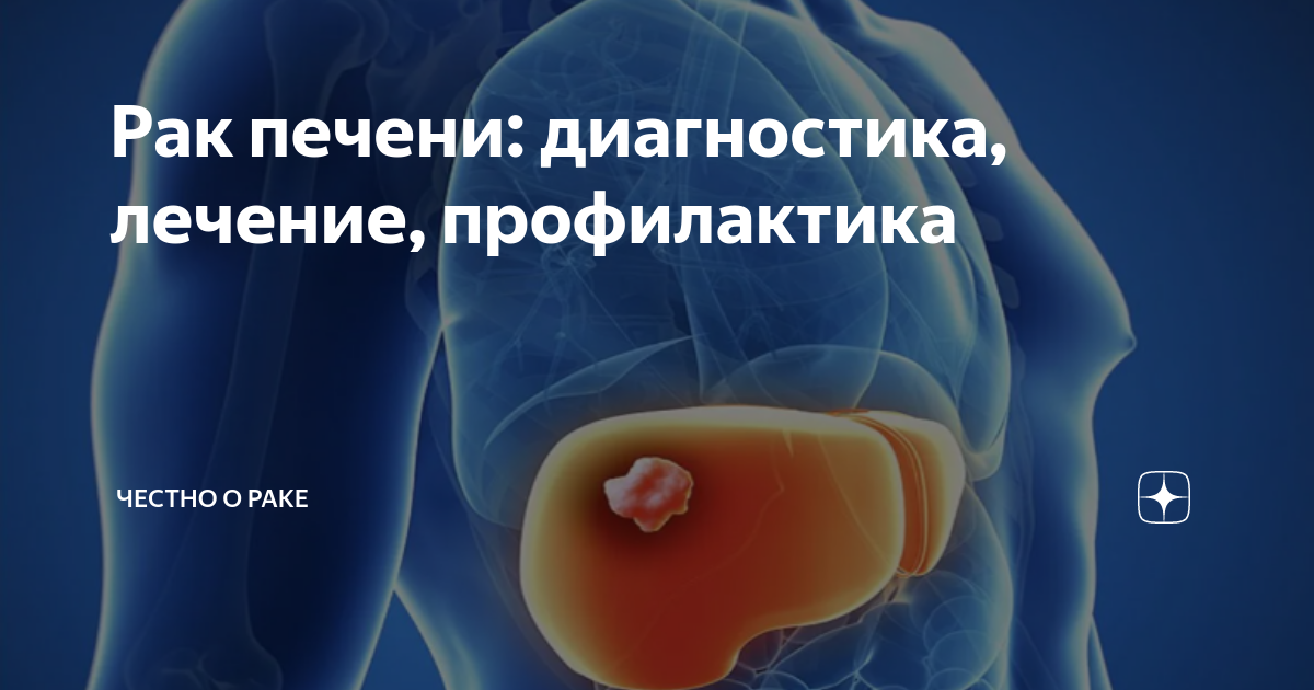 сколько живут с раком печени если не лечить