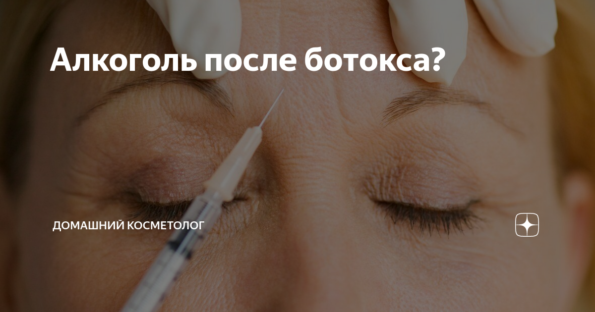 Алкоголь после ботокса. Алкоголь после после ботокса. Алкоголь после уколов ботокса. Алкоголь после диспорта.