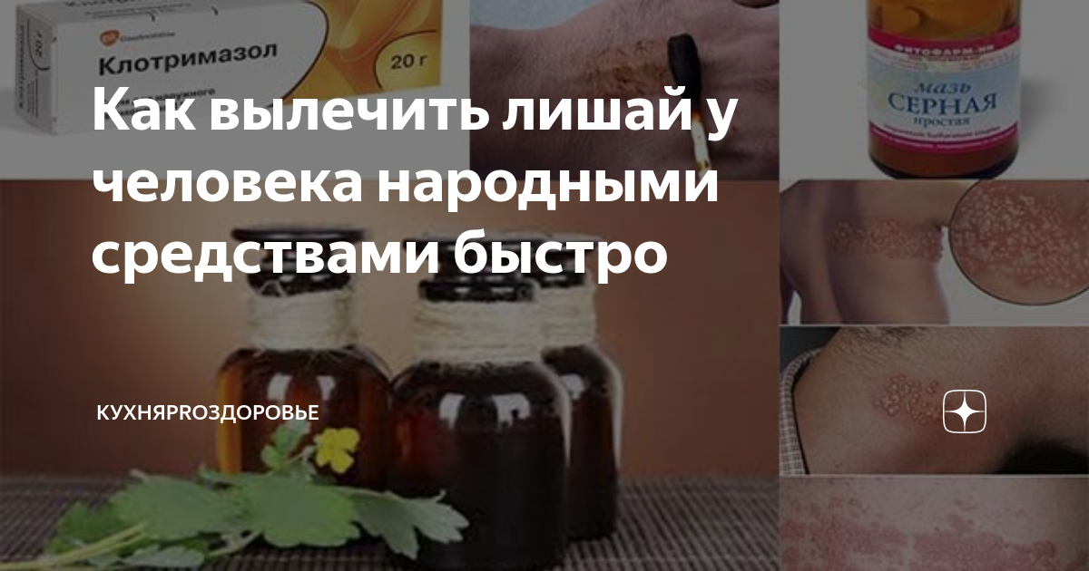 Как вылечить лишай у человека народными средствами быстро