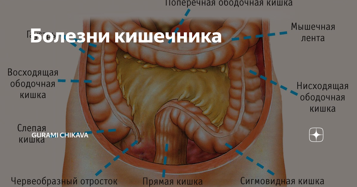 Кишка с правой стороны. Селезеночный изгиб ободочной кишки. Ободочная кишка строение. Сигмовидная кишка анатомия. Толстая кишка анатомия болезни.