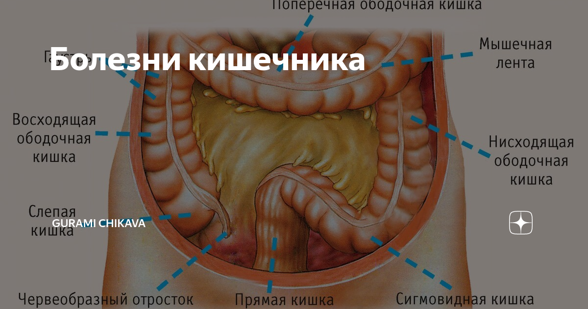 Кишечник форум врачей. Селезеночный изгиб ободочной кишки. Ободочная кишка строение. Сигмовидная кишка анатомия. Толстая кишка анатомия болезни.