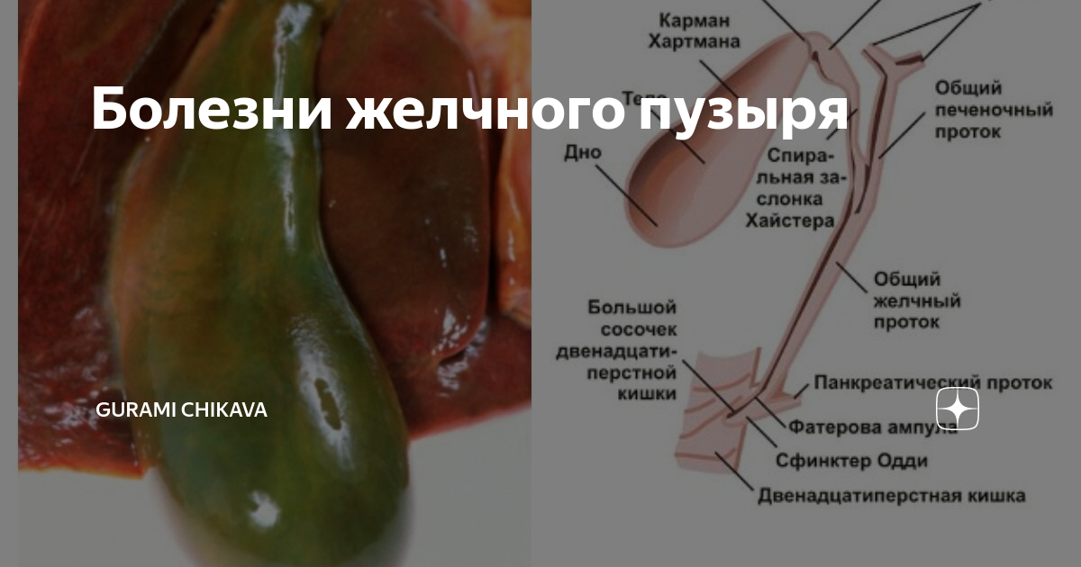 Желчный пузырь это. Желчный пузырь человека. Желчный пузырь в разрезе. Проток желчного пузыря открывается в