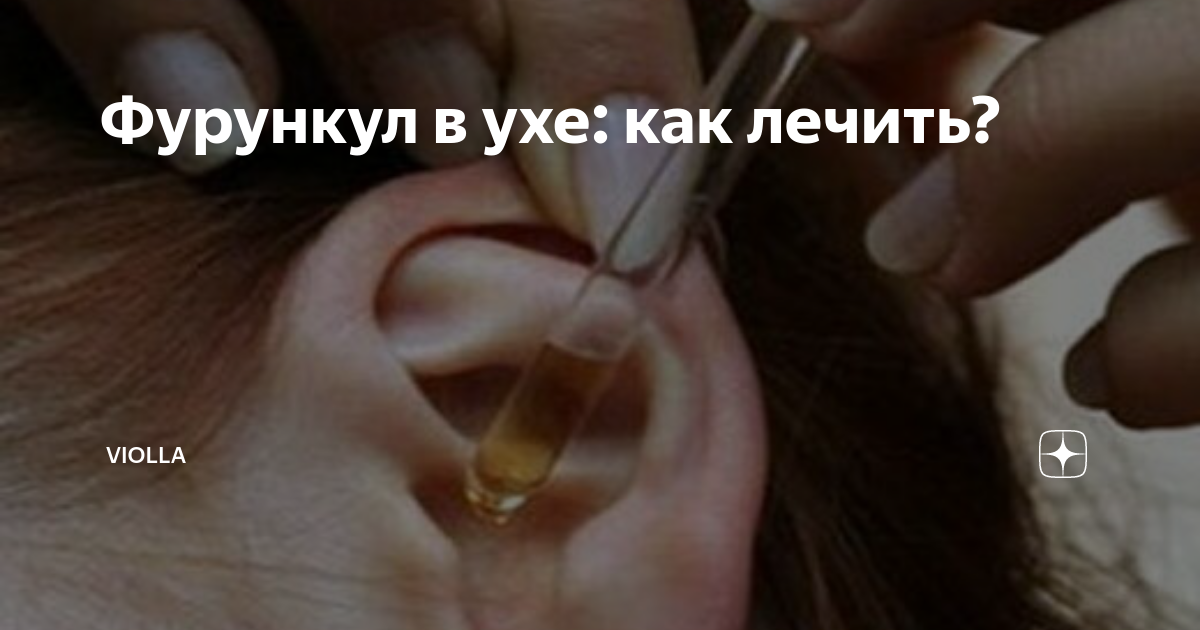 Лечение фурункула уха в Пятигорске - цена на лечение фурункула в ухе