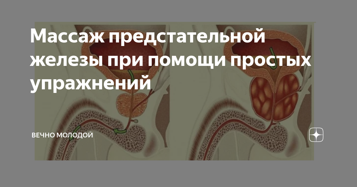 Упражнения при простатите для мужчин: какие можно и нужно выполнять в домашних условиях