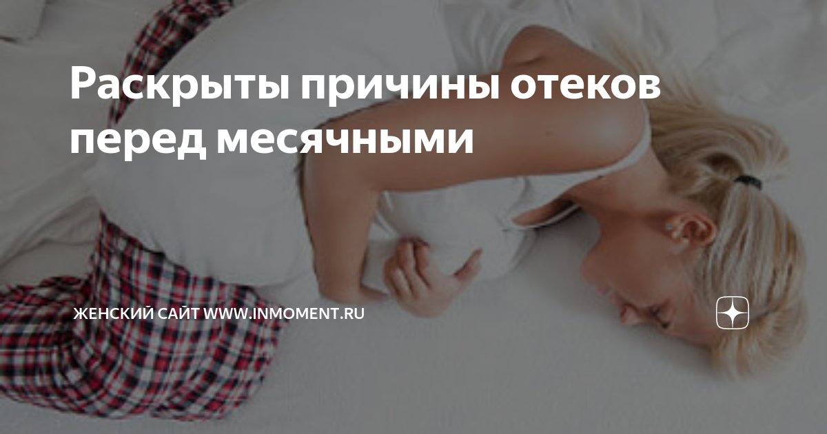 Отек перед месячными причины. Отёчность перед месячными причины. Сильные отеки перед месячными. Сильная отечность перед месячными.