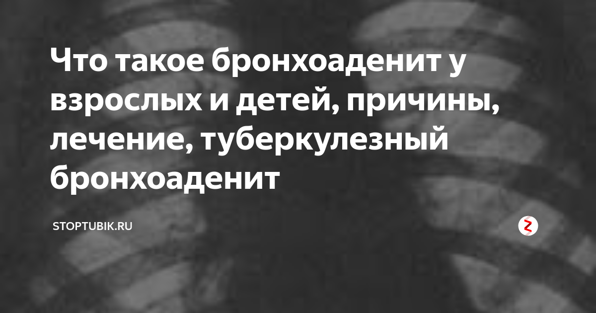 Статьи по здоровому образу жизни | ГУЗ 