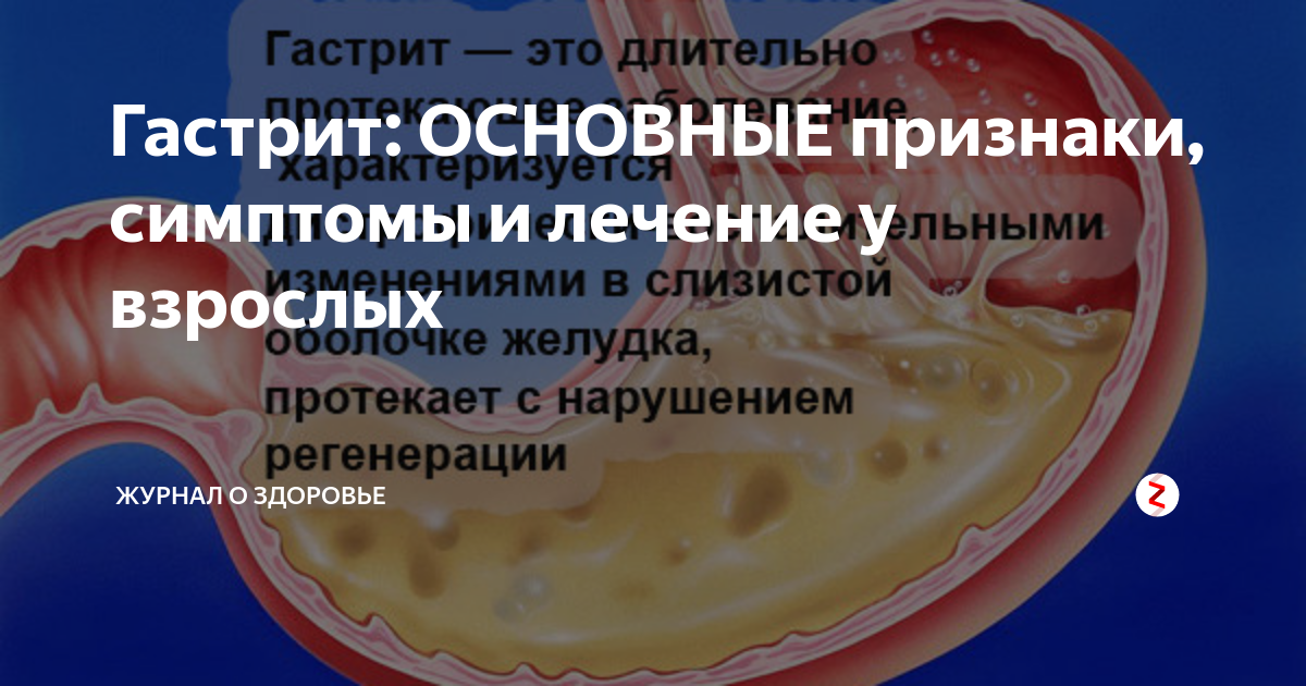 Признаки гастрита. От чего появляется гастрит у взрослых. Проявления уремического гастрита.