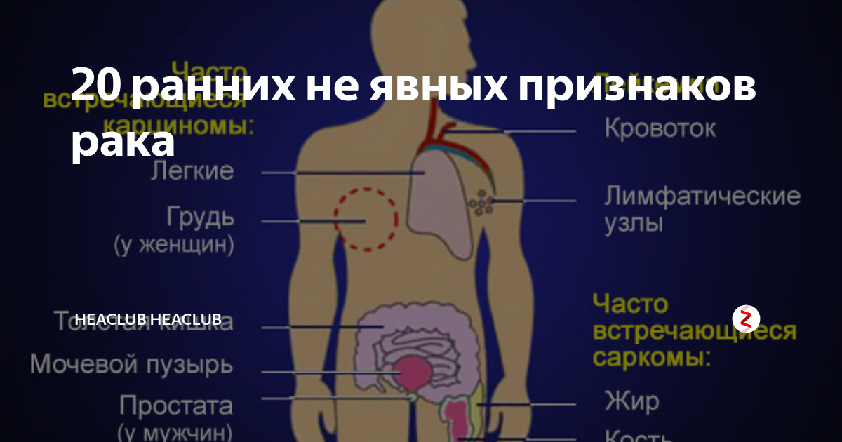 Мужчина рак как проверяет. Симптомы раковых заболеваний человека. Симптомы онкологических заболеваний. Первые признаки онкологии в организме человека. Симптомы опухолевых заболеваний