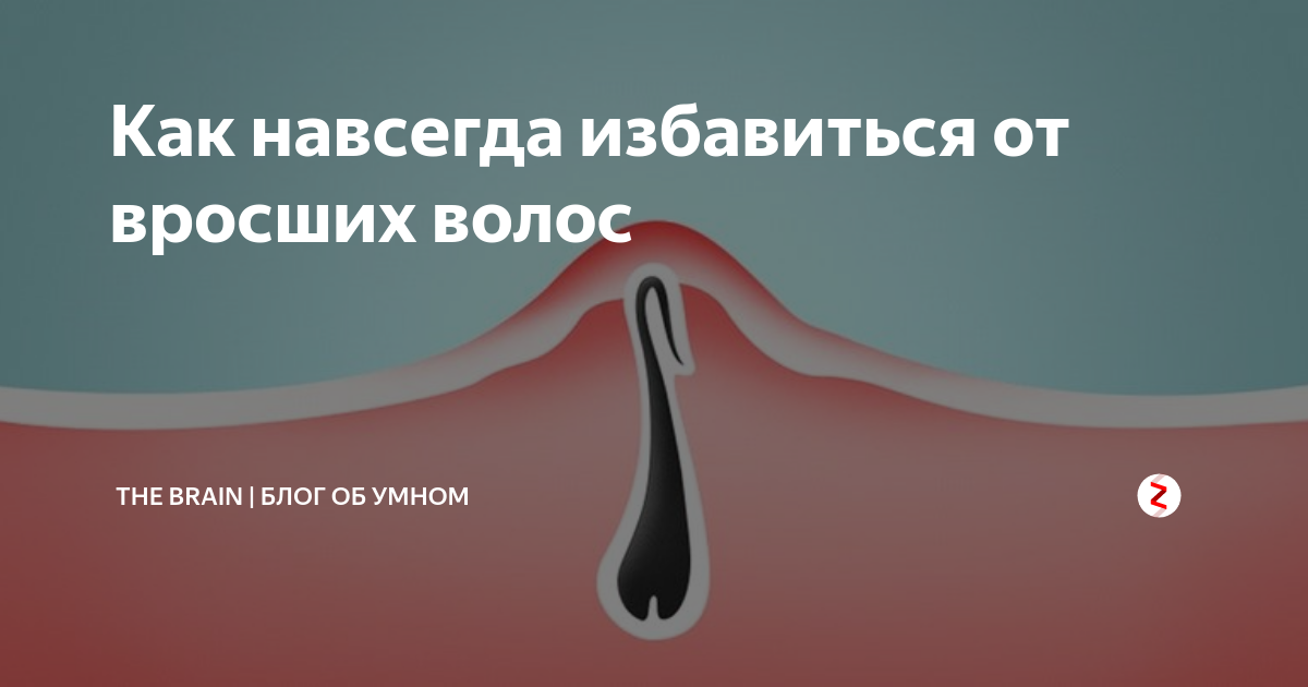 Как навсегда избавить