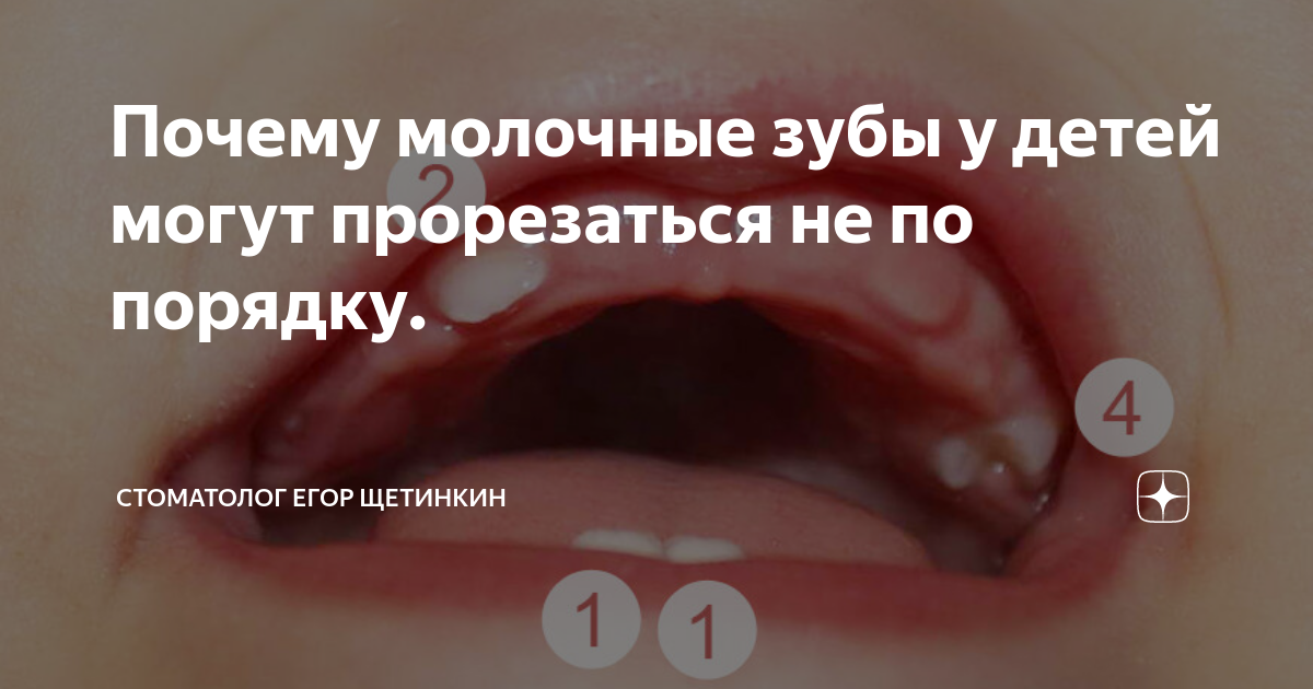 черные молочные зубы у детей что это