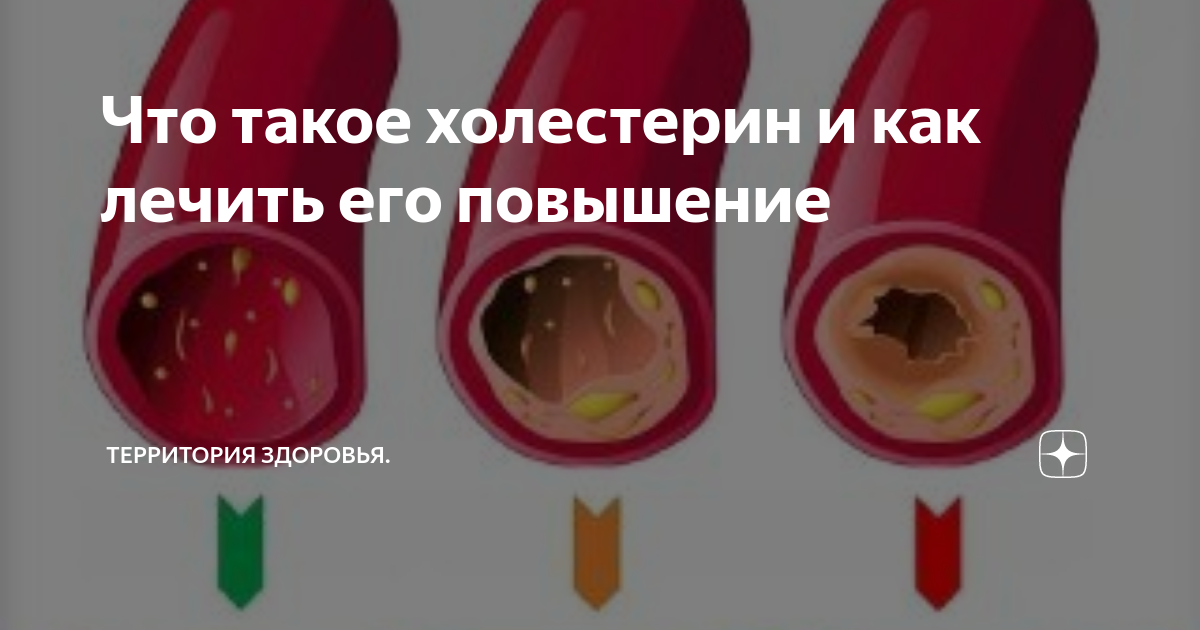Повышенный холестерин что это такое. Повышенный холестерин что это такое