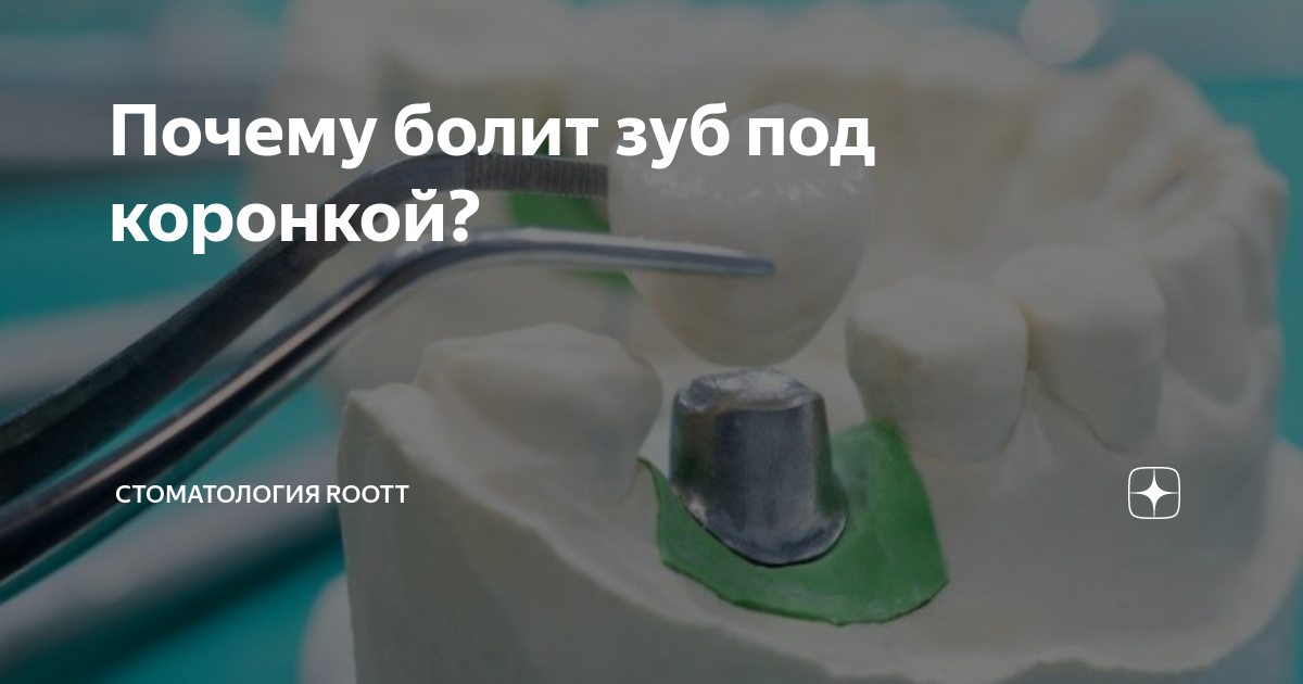 что можно сделать если болит зуб под коронкой