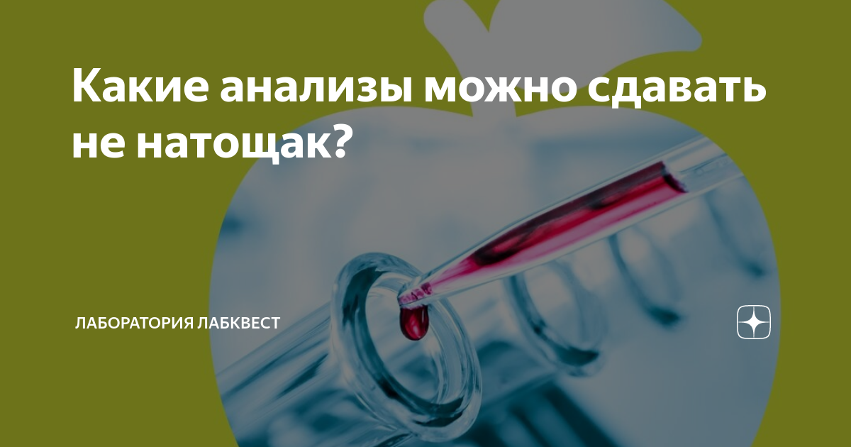 какие анализы можно сдавать не на голодный желудок