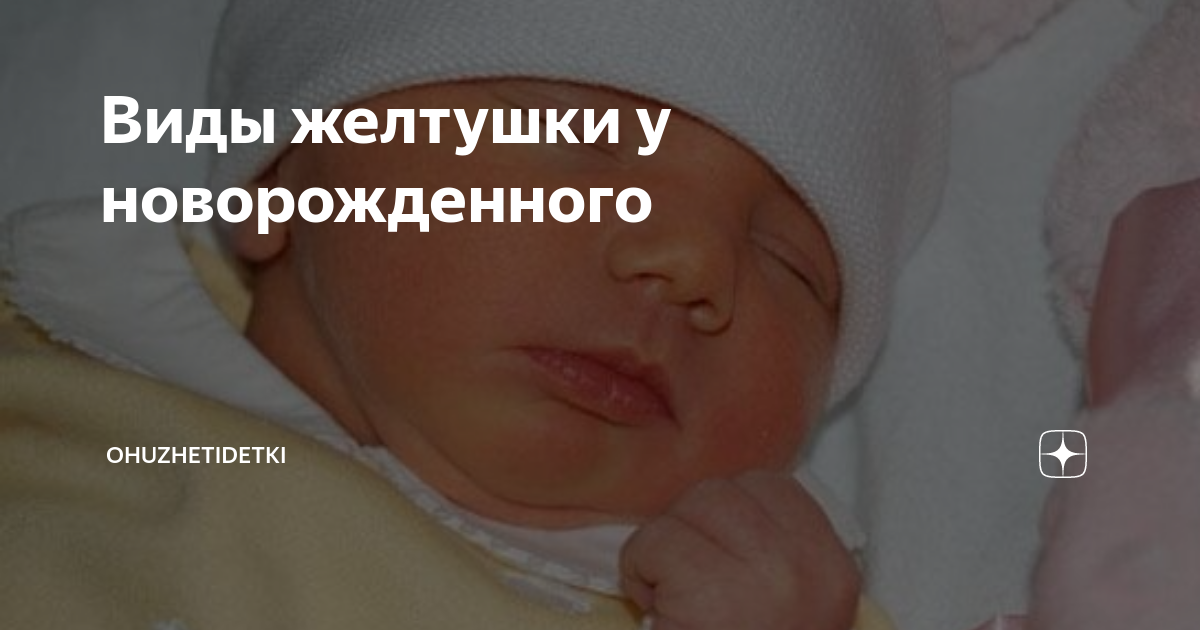 Желтушка от прививки от гепатита новорожденным. Фетальный гепатит у новорожденных протокол. Гепатит схема вакцинации грудничков. Прививку от гепатита новорожденным. Побочные эффекты прививки.