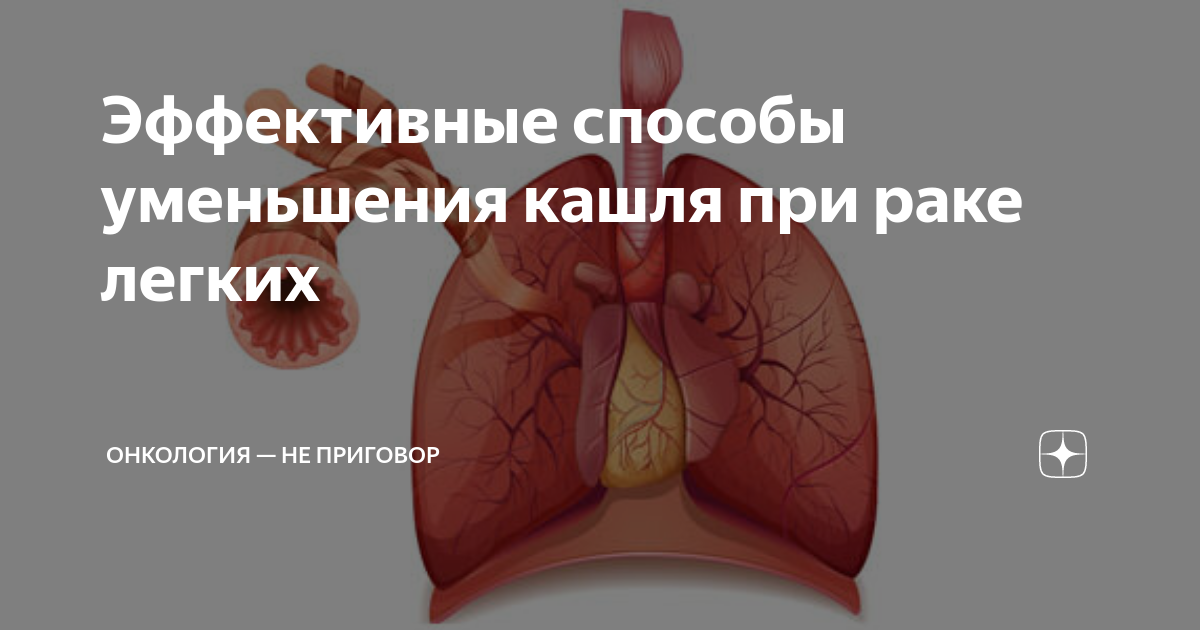 Можно ли пить при раке легких. Кашель при онкологии легких. при онкологии кашель внутренние болезни. как уменьшить кашель в онкобольного легких.