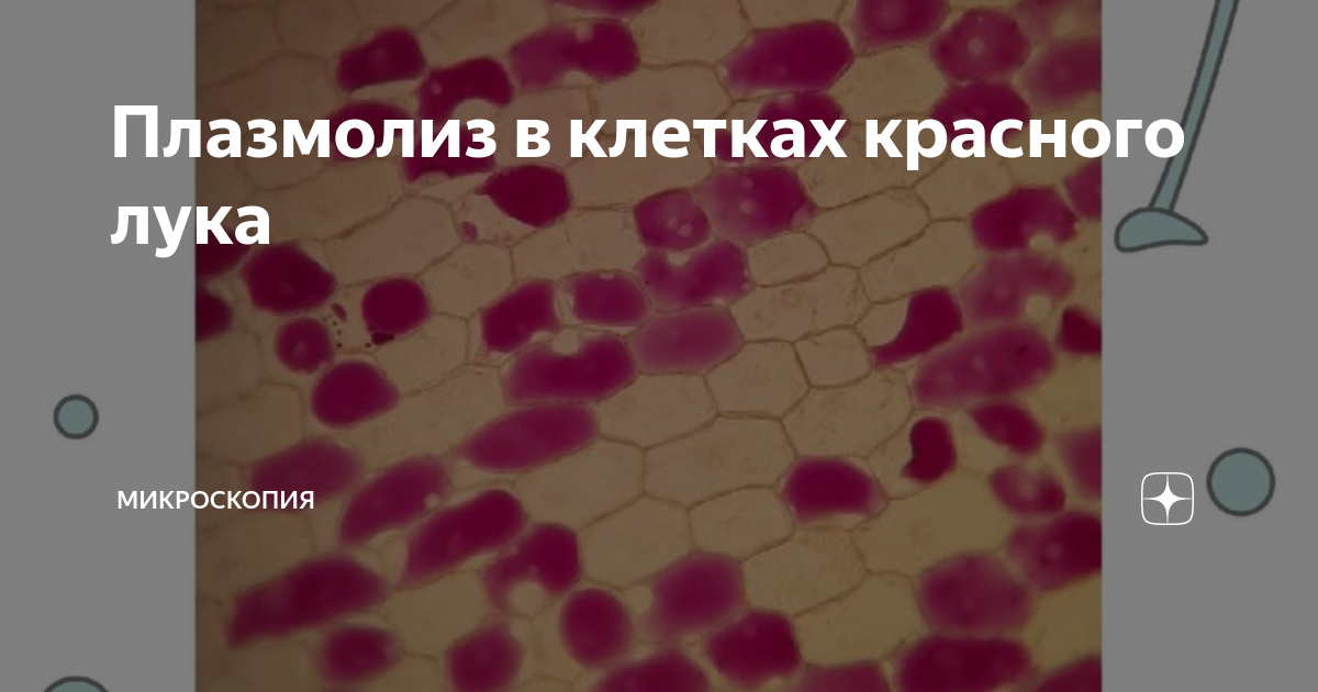 Плазмолиз в клетках красного лука | Микроскопия | Дзен