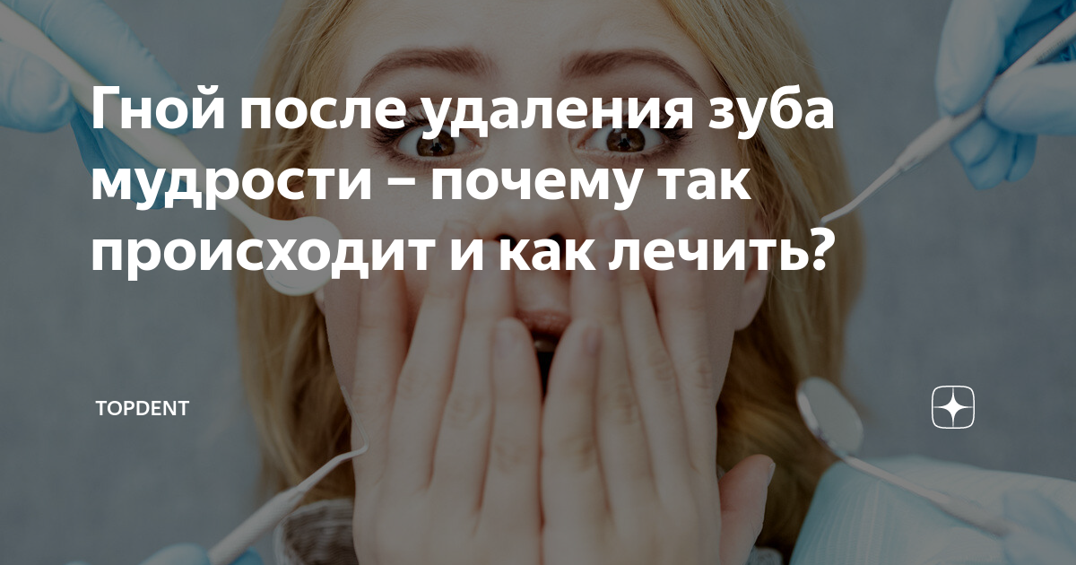 Гной после удаления зуба: причины, признаки, осложнение, профилактика, лечение