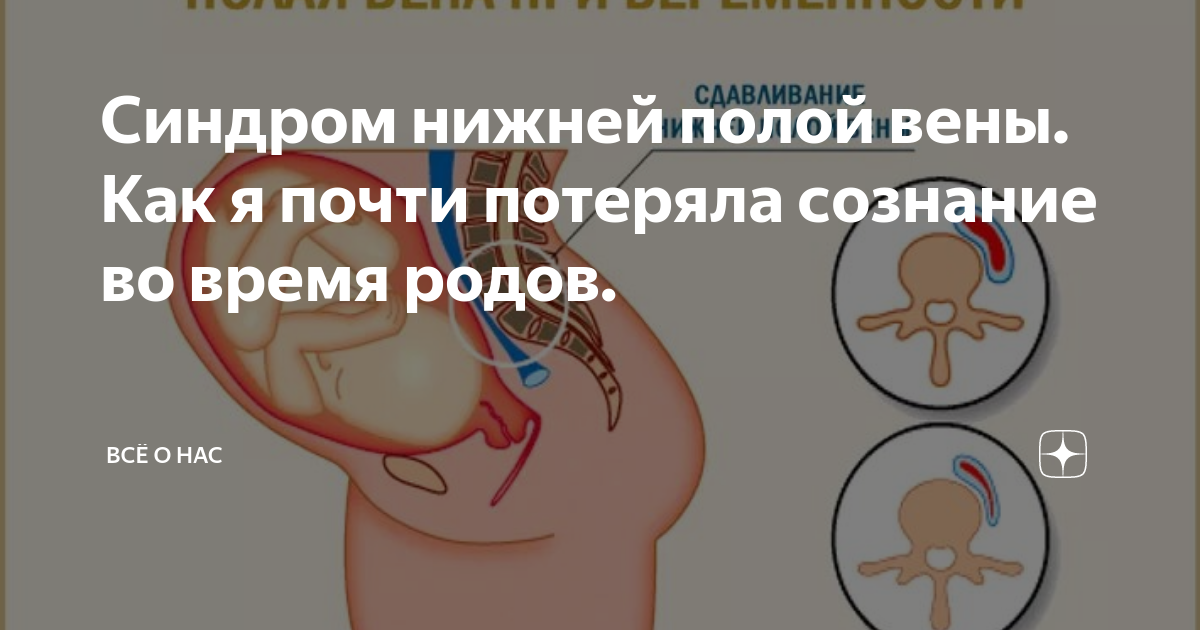 Полая вена при беременности фото страница 3 Фото Pregnancy Bumps, более 91 000 качественных бесплатных стоковых ф