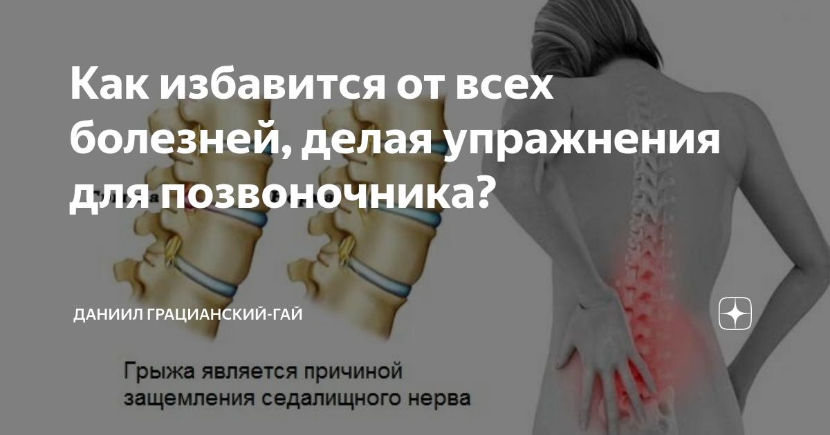 Защемление в грудном отделе что делать