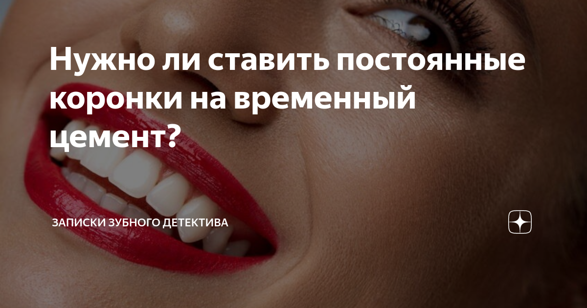 Нужно ли ставить постоянные коронки на временный цемент? | записки ...