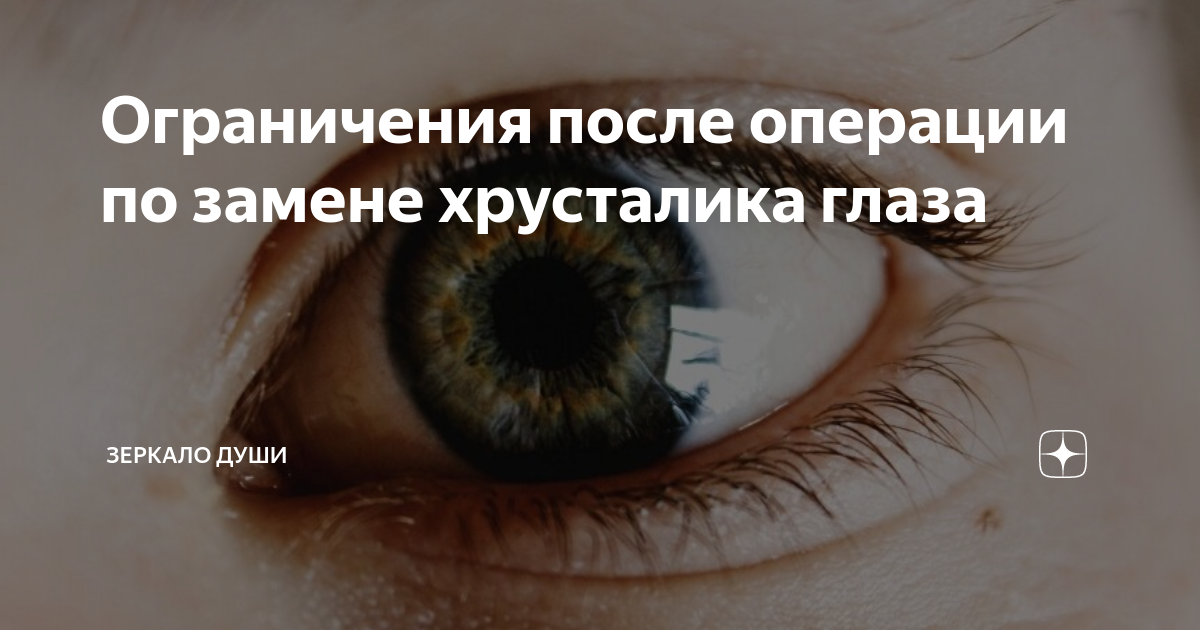 Как вести себя после операции по удалению катаракты глаза (замене хрусталика на ИОЛ)