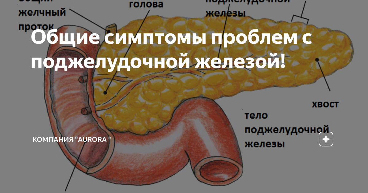 Поджелудочная железа как проверить. Поджелудочная железа симптомы. Болит поджелудочная железа симптомы. Поджелудочной железы симптомы болезни. Поджелудочная железа у мужчин