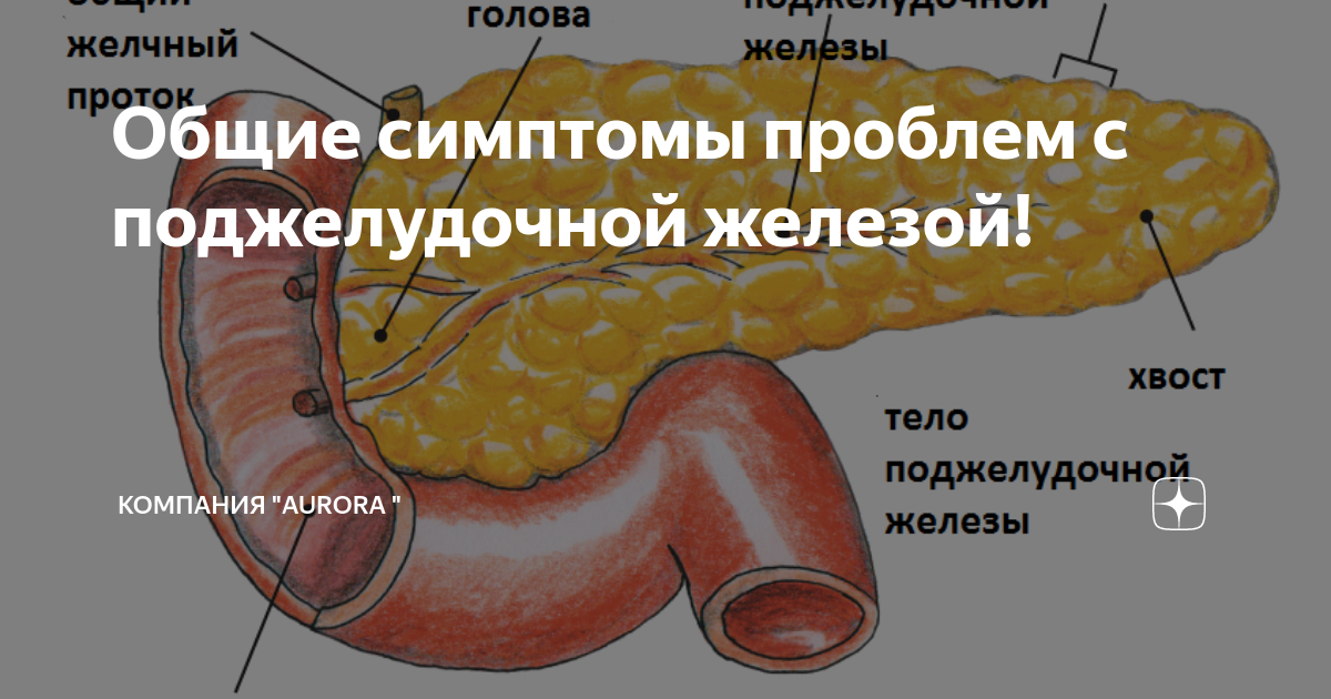 Болит поджелудочная железа симптомы и лечение. Поджелудочная железа симптомы. Болит поджелудочная железа симптомы. Поджелудочной железы симптомы болезни. Поджелудочная железа у мужчин.