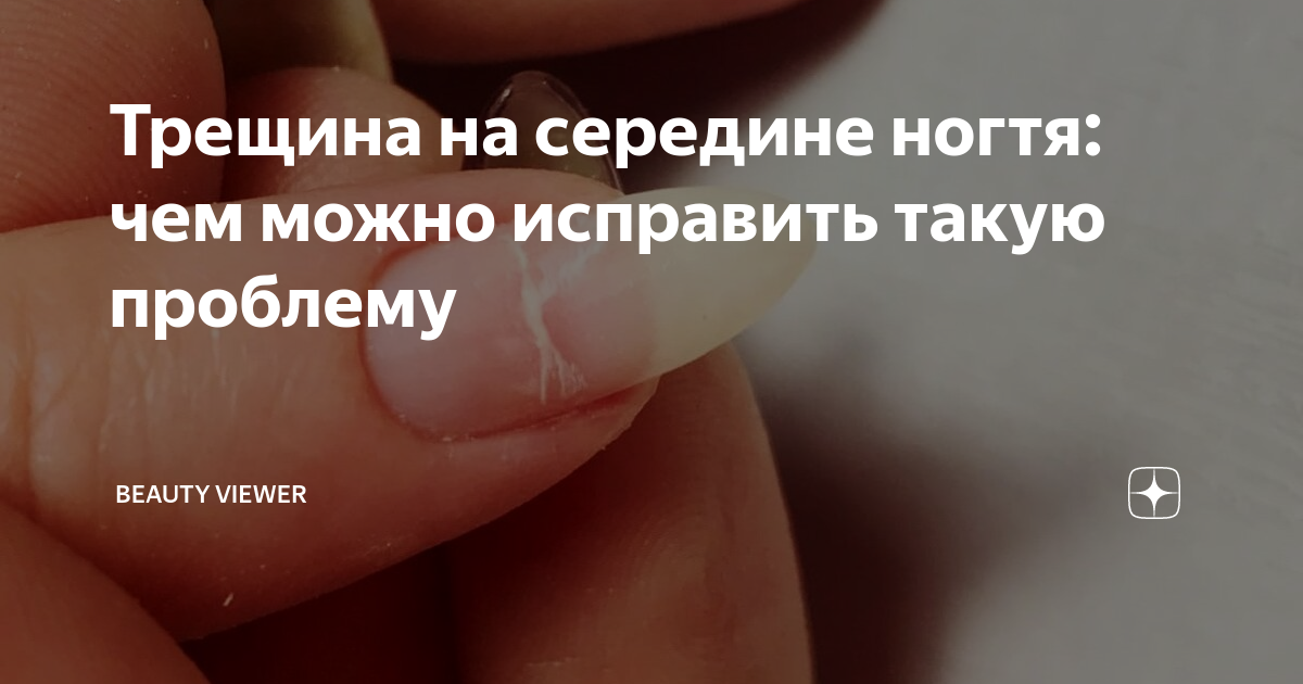 Трещина на середине ногтя: чем можно исправить такую проблему | Лизи ...