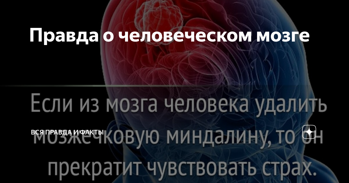 Вклинение головного мозга - Неврологические расстройства - Справочник MSD Профессиональная версия