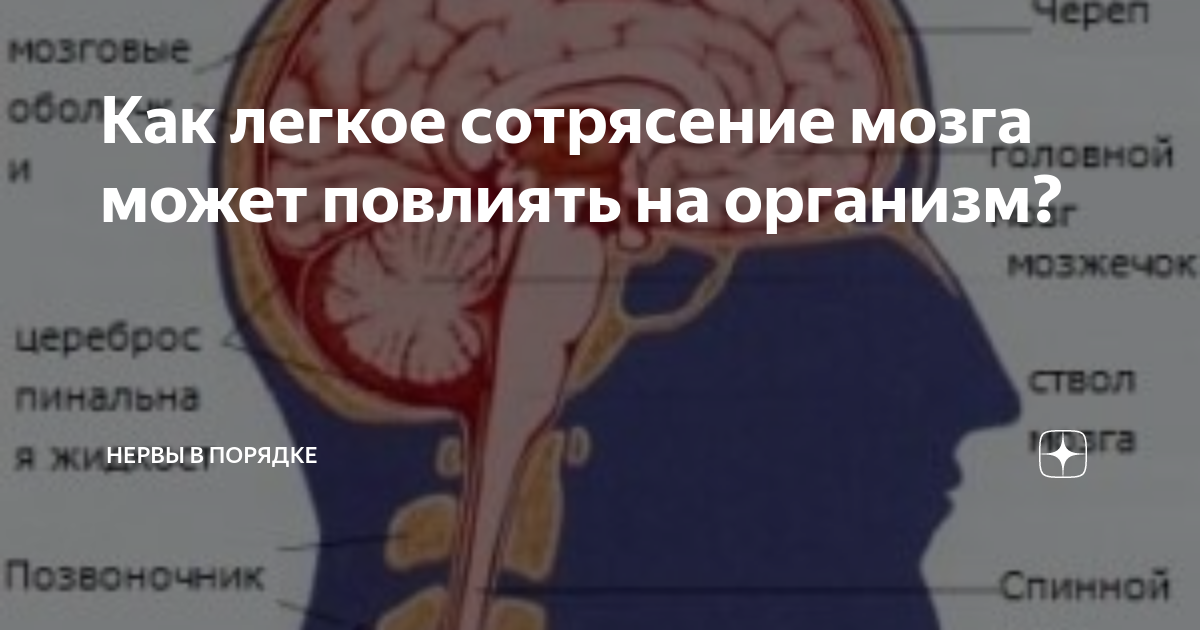 Царапина по сравнению с сотрясением мозга 6. Симптомы легкого сотрясения.