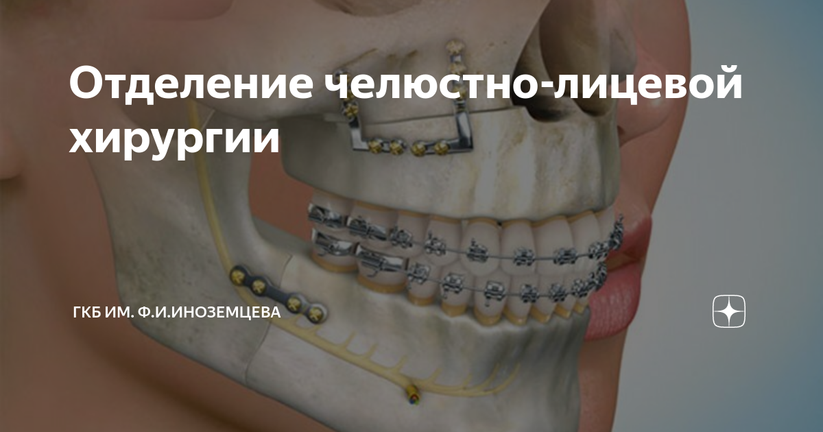 Платные услуги челюстно лицевая