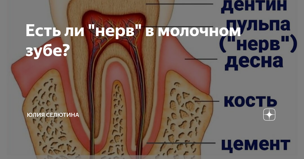 Есть ли нерв. Пришеечный кариес схема.