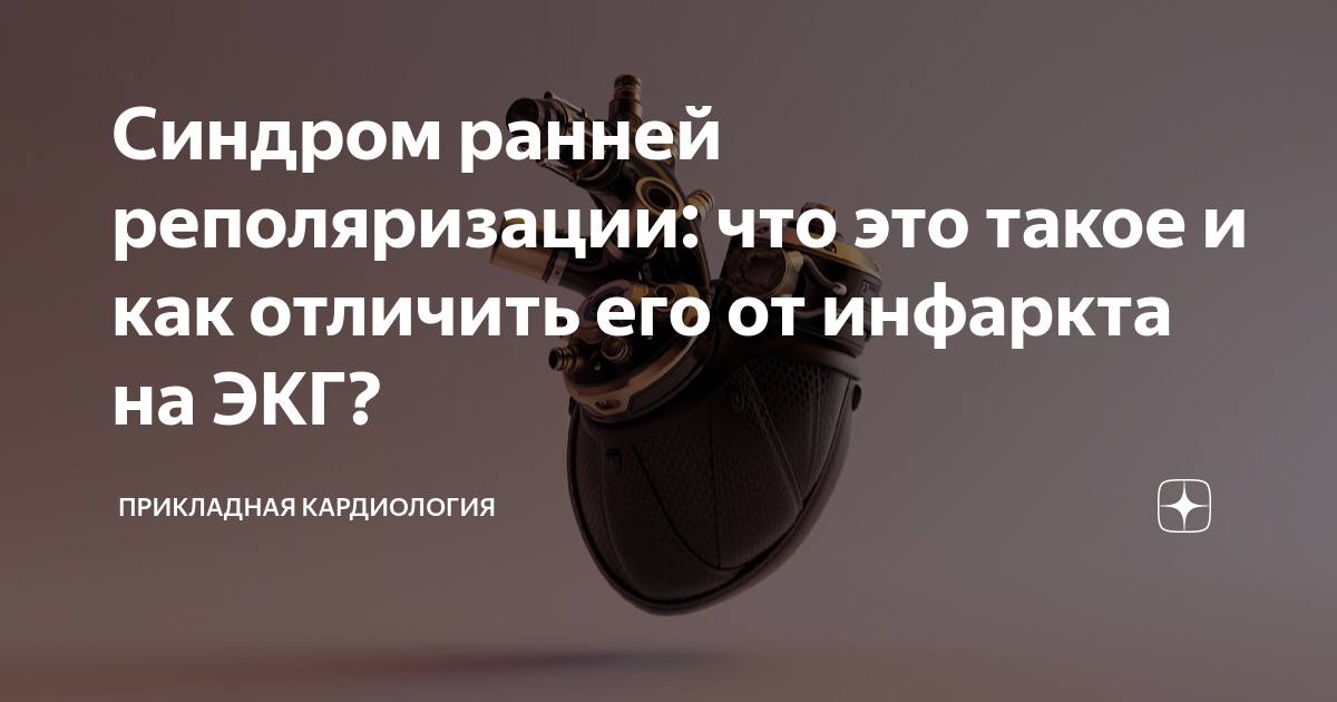 Синдром ранней реполяризации: что это такое и как отличить его от ...