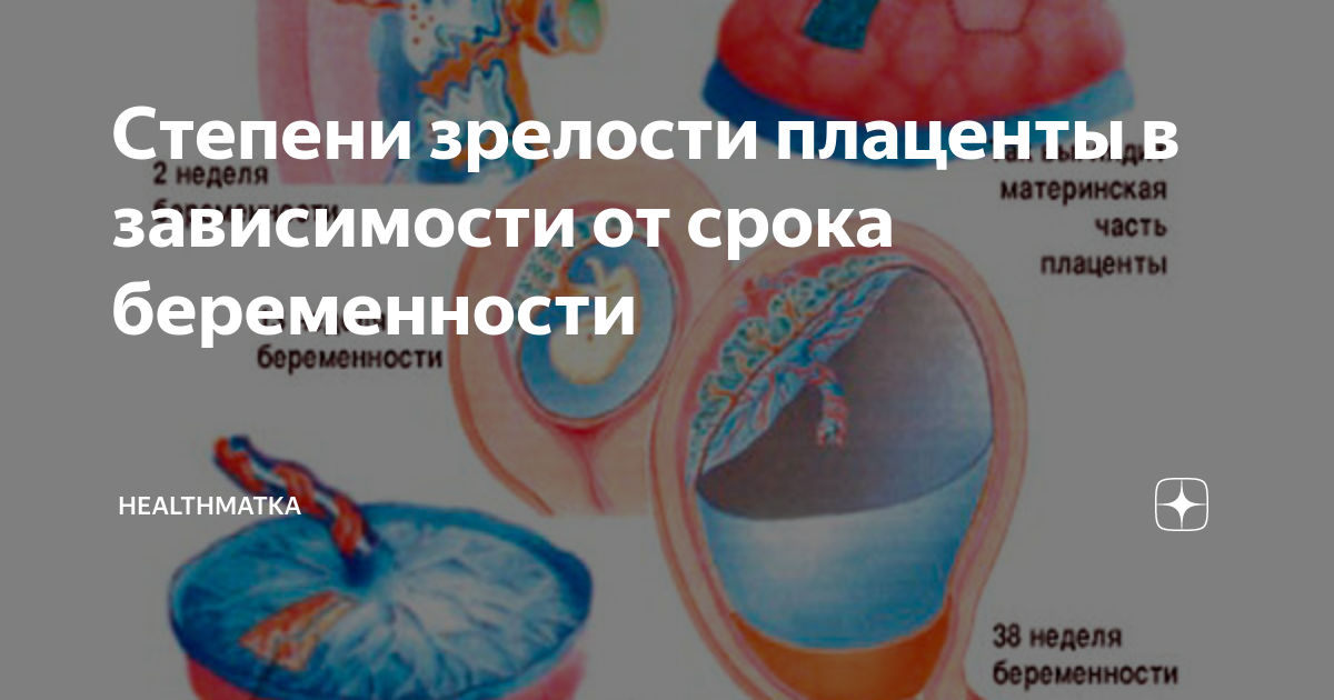 Таблица степени зрелости плаценты. Степень плаценты. Степень созревания плаценты. Стадии старения плаценты. Этапы старения плаценты.