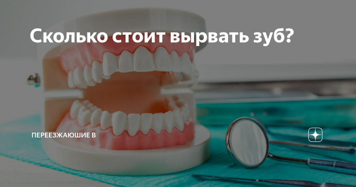 Удаление ретинированного дистопированного зуба. Расценки на вырывание зуба. Вырывают зуб в стоматологии. Сколько будет стоить вырвать зуб. Сколько будет стоить вырвать зуб.