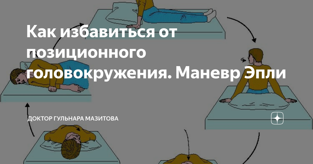 Вестибулярная гимнастика маневр Эпли. Маневр Семонта. Маневр Брандта-Дароффа. Упражнения при головокружении.