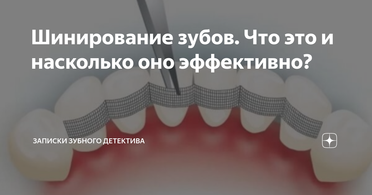 Зубной детектив дзен. Зубной детектив дзен. Записки зубного детектива дзен. Записки зубного детектива дзен. Зубной детектив дзен.