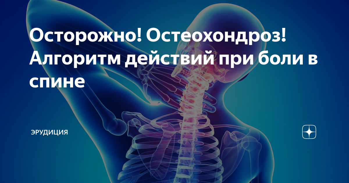 Шейный остеохондроз симптомы у женщин. Остеохондроз это простыми словами. Шейный остеохондроз симптомы у мужчин. Шейный хондроз симптомы у мужчин.