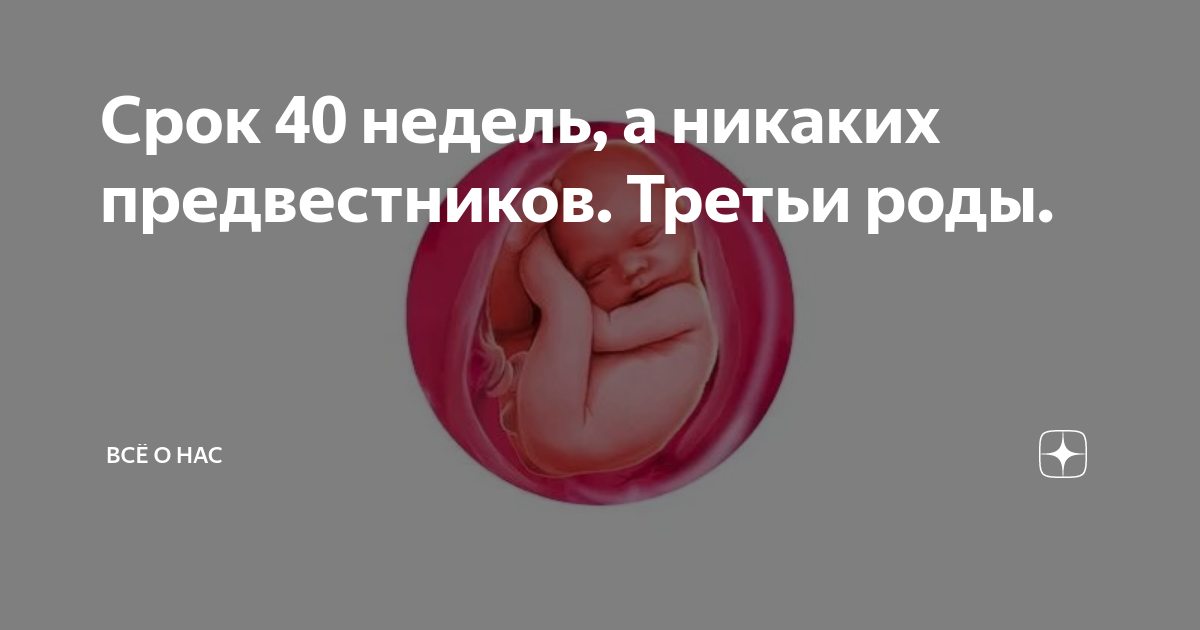 40 недель россия. Схватки на 39 неделе беременности. Роды на 40 неделе беременности.
