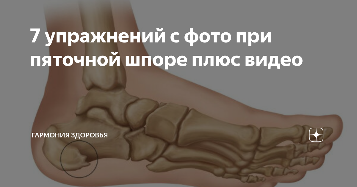 Пяточная шпора карта вызова