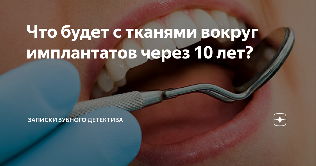 Через 10. Записки зубного детектива импланты. Записки стоматолога детектива. Записки зубного детектива дзен. Записки зубного детектива дзен импланты.