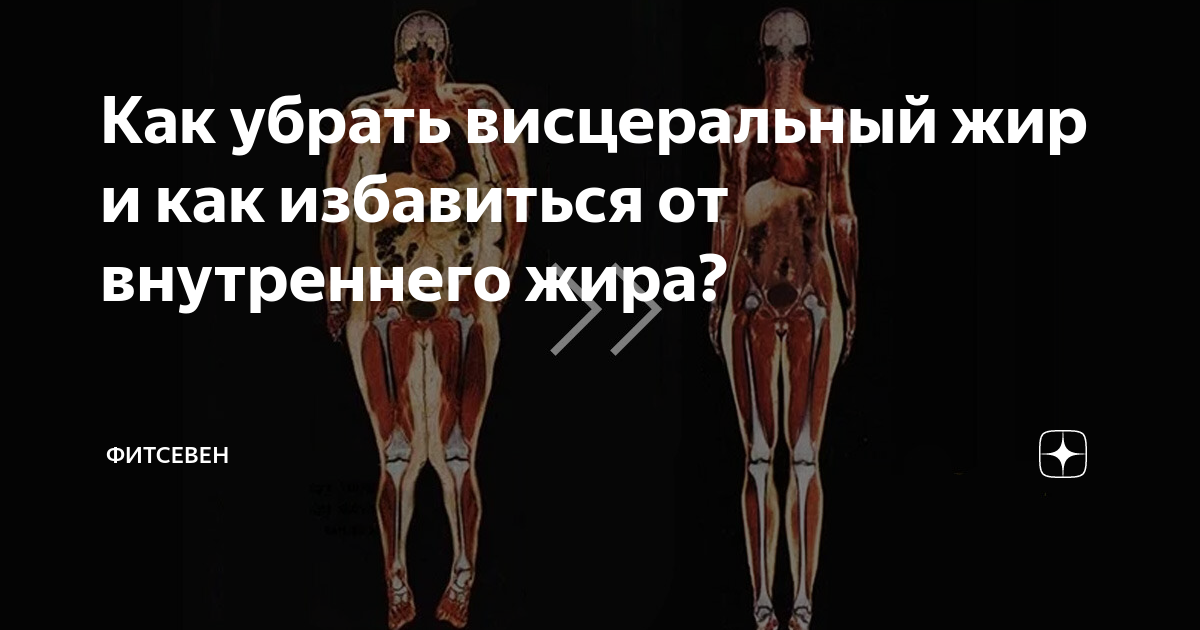 как быстро убрать висцеральный жир на животе